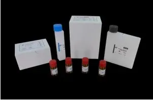 Rheumatoid Factor RF Test